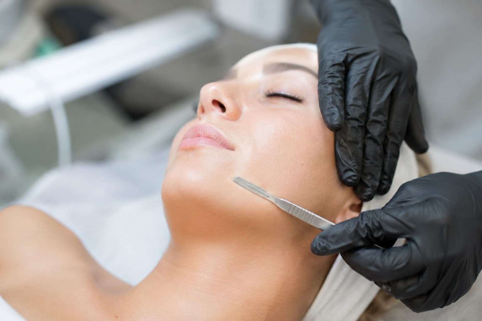 Dermaplaning